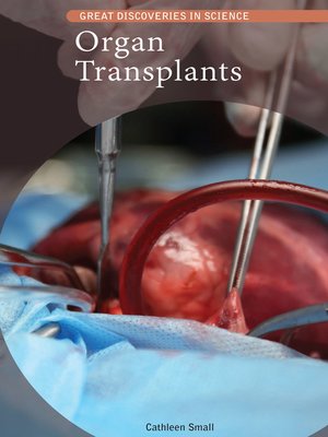 cover image of Organ Transplants
